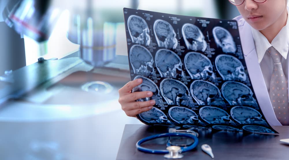 Young female doctor in uniform examining an MRI or CT scan picture in a medical office for diagnosing a brain injury.